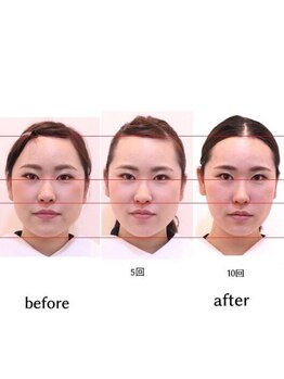 ワンネス 平林店(One’Ness)/エラ張撃退!余白を無くし小顔へ