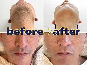 キングスサロン 熊本