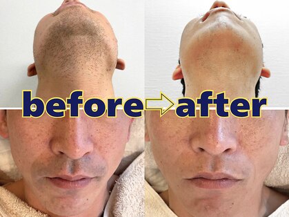 キングスサロン 熊本の写真