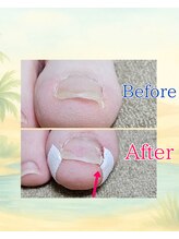 リフロー 湖南店(re-flow)/2児の産後ママさん