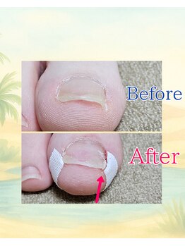 リフロー 湖南店(re-flow)/2児の産後ママさん