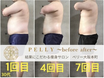 ペリー(PELLY)/男性30代　before after