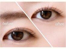 クロム アイプラス 狭山 入曽店(CHROM eye+)/下がりまぶた改善