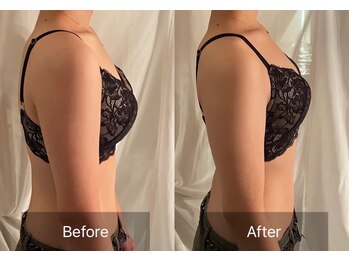 ハートランド(HEARTLAND)/プチ・クレオパトラ☆1回の施術