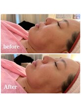 ルミナス(Luminous)/美肌＆小顔