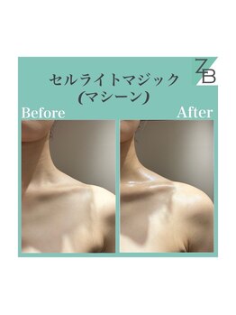 ザラハビューティー(ZARAHA Beauty)/C'elluliteMagic