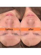 サクラ スパ(SAKURA SPA)/毛穴リメイクコース