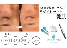 サロンド ララ(Salon de lala)
