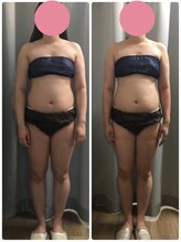 ミロク(369)/脂肪冷却痩身　20カップ終了