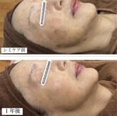 ミニョン(Mignon)