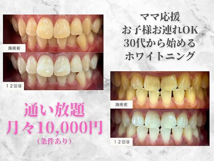 ロベリア(LoveliA)の写真