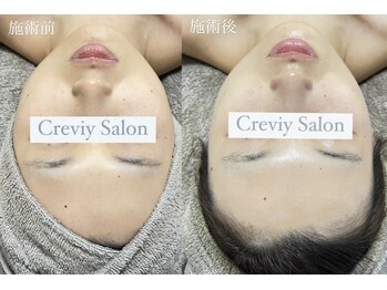 クレヴィー(Creviy)/透き通る透明感