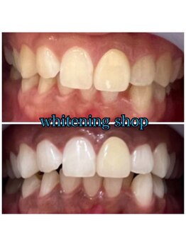 ホワイトニングショップ 葵区静岡駅店/ホワイトニング店ホワイトニング