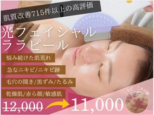 チャパン(Chapan)