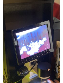 ミオン(Mion)/カウンセリングにて血流確認→