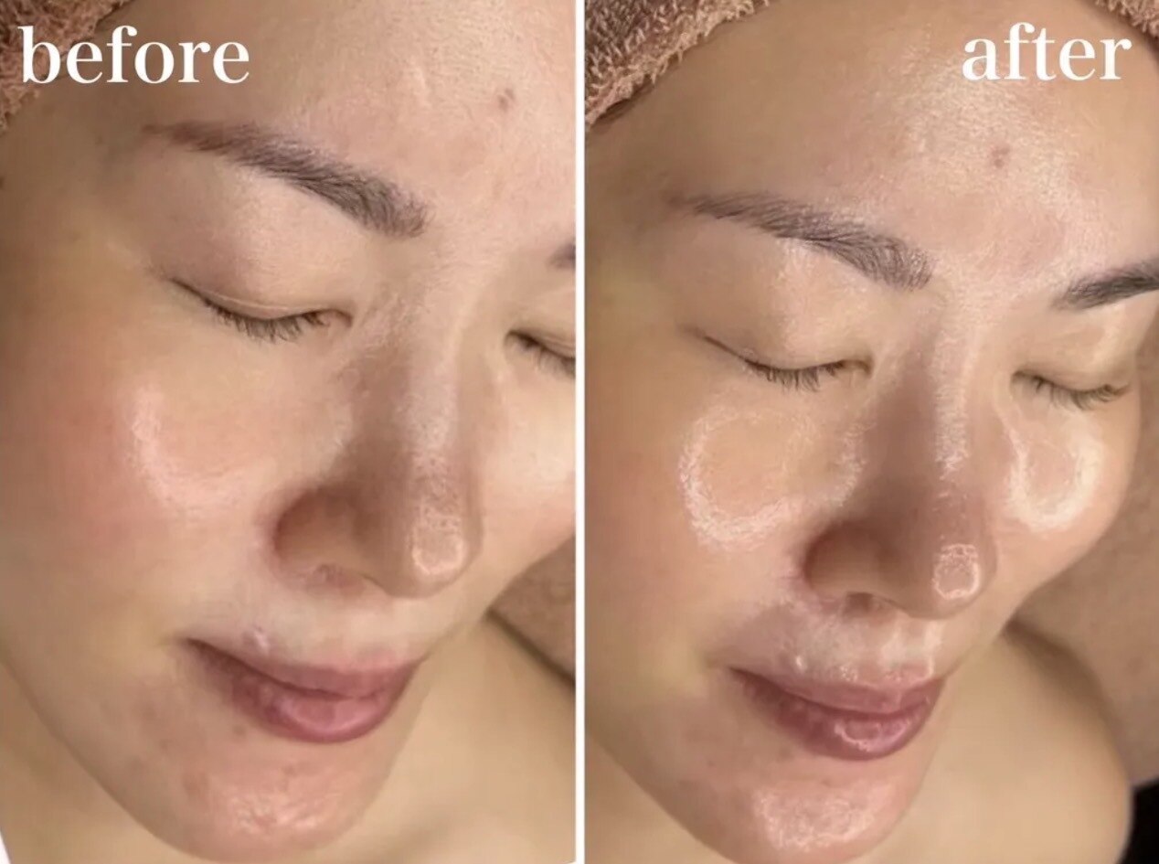 ホワイトアクア 北堀江店(WHITE AQUA)｜ホットペッパービューティー