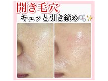 ホワイトアクア 加古川店(WHITE AQUA)の雰囲気（韓国最先端美容のララピールでお肌の内側からツヤぷるな水光肌！）