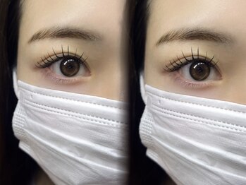ミニョン(Mignon)の写真/【目の形にお悩みの方に】経験・知識豊富なスタッフがあなたのお悩みに合わせて多数のメニューからご提案♪
