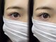ミニョン(Mignon)の写真/【目の形にお悩みの方に】経験・知識豊富なスタッフがあなたのお悩みに合わせて多数のメニューからご提案♪