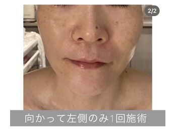 エラフリー/気持ち良く、分かりやすい効果◎