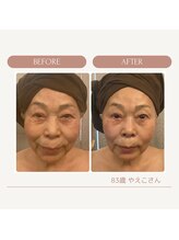 イロハナ(iro-hana)/シワたるみケア