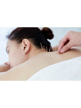 鍼灸施術を受けたい