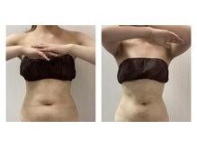 BBC 田園調布/【痩身】上半身/お腹+ウエスト腰