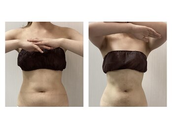 BBC 田園調布/【痩身】上半身/お腹+ウエスト腰