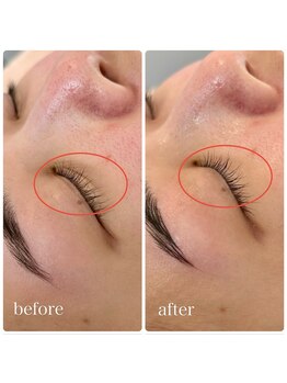 ムク(Muk.)/シワ・シミ・乾燥改善ピーリング