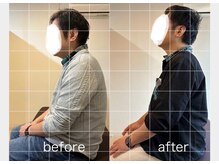 ゼンス整体 下北沢院(ZENCE整体)/施術のビフォーアフター