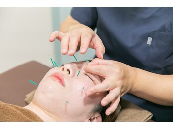 代官山アサ接骨院 鍼灸院(代官山 Asa 接骨院 鍼灸院)/美容鍼むくみ・リフトアップケア