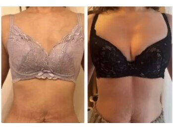 スマイルクルー(SmileClue)/ビフォーアフター症例