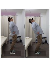 ナオル整体 札幌白石院(NAORU整体)/反り腰・腰の硬さ｜後屈改善