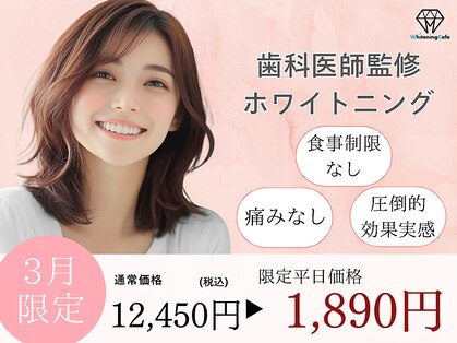 ホワイトニングカフェ 志木店の写真