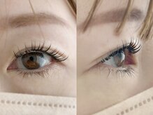 ムニ(muni)/&healthy【アンドヘルシー】