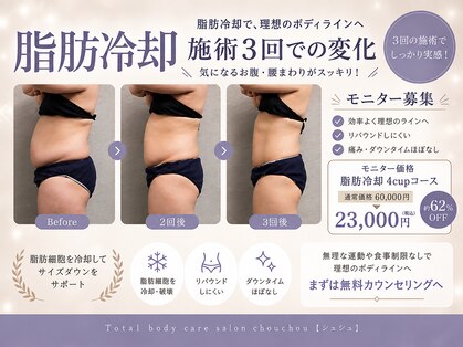 シュシュ(chouchou)の写真