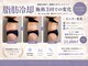 シュシュ(chouchou)の写真