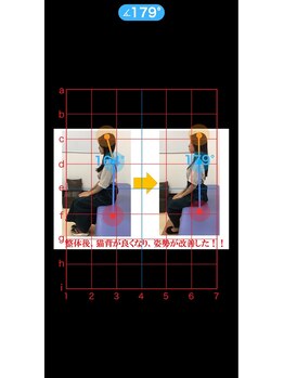 やぎはし整体院 柏駅東口店/姿勢ビフォーアフター
