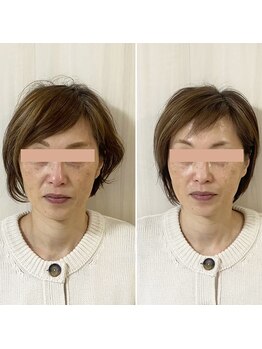 サロン ウェル(SALON WELL)/【50代 小顔エイジングケア】