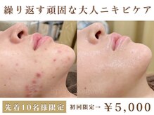 フェイシャル専門店 エピア 掛川店(Epia)