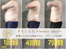 ペリー(PELLY)/男性30代　before after