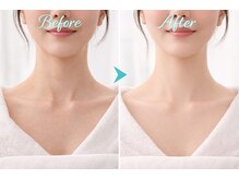 アプロ(Aphro)/首元若見え変化