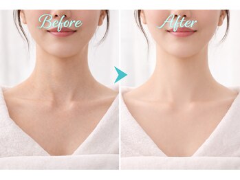 アプロ(Aphro)/首元若見え変化