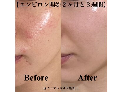 リンク(Link)の写真