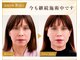 サロンチオリ 烏丸(Salon Chiori)の写真/長く通う理由は、変化を実感できるから。40代から結果にこだわる大人女性が通う、顔と体を整える小顔矯正