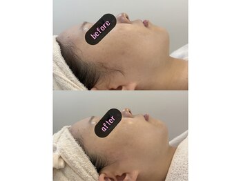 サロン ド モモ(salon de momo)の写真/秋の艶肌作りはリアボーテのトリートメントで艶のある透明感のあるお肌を☆ブライダルにもおススメです♪