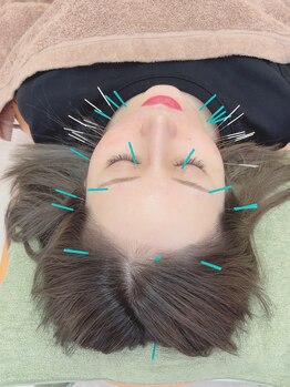 ヒーリングサロン アージュ(A-je)/★美顔鍼＋小顔矯正★