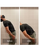 朱雀整骨院/可動域が広がります！