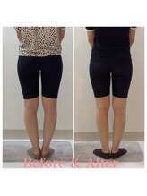 スタイルラボ高松/骨盤矯正の効果♪