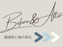 アントルーチェ 代々木上原(Entluce.)/Before & After